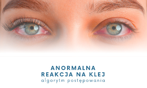 ANORMALNA REAKCJA NA KLEJ - ALGORYTM POSTĘPOWANIA